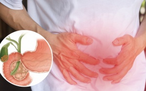 Có cách nào trị sỏi mật, tránh phải phẫu thuật?