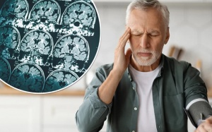 Mối liên hệ giữa tăng huyết áp và bệnh Alzheimer