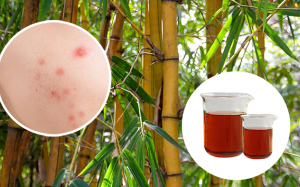 Giấm tre – thành phần tự nhiên với tiềm năng trị mụn