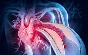 TPBVSK Ích Tâm Khang Platinum có tốt cho người bị thiếu máu cơ tim không?