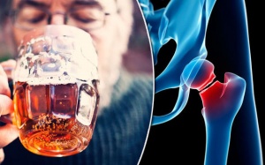 Uống rượu gây hại cho xương khớp thế nào?