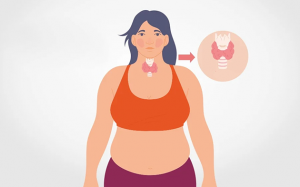 Cách khắc phục tình trạng tăng cân do suy giáp