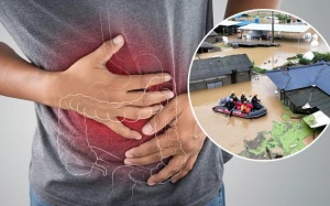 Chuyên gia chia sẻ: Cách ứng phó với dịch bệnh sau bão lũ