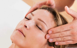 Châm cứu có thể điều trị rối loạn lo âu?