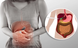 Đau bụng, buồn nôn, khó tiêu  là triệu chứng bệnh sỏi mật hay dạ dày?