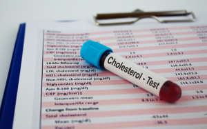 Những thay đổi trong lối sống để cải thiện cholesterol và bảo vệ trái tim của bạn