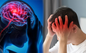 Người có những yếu tố nào thì dễ đột quỵ?