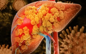 Dấu hiệu cảnh báo gan đang bị tổn thương