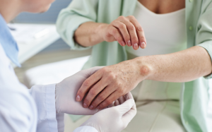 Giải đáp thắc mắc: Bệnh vảy nến có lây không?