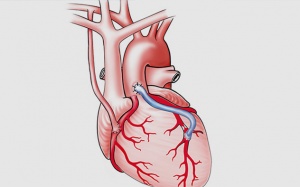 Hẹp mạch vành: Bắc cầu mạch vành có nguy hiểm không?