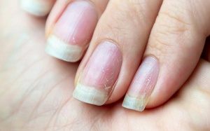 5 thói quen khiến móng tay yếu và dễ gãy