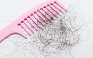 Giảm cân có thể là nguyên nhân gây rụng tóc?