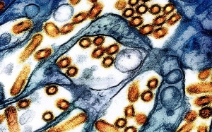 Canada phát hiện ca nhiễm cúm gia cầm đầu tiên ở người