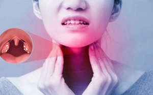 Thực phẩm tốt cho người bệnh viêm amidan