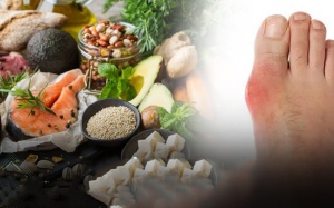 2 cách cải thiện nhanh triệu chứng bệnh gout