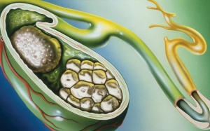 TPBVSK Kim Đởm Khang có hiệu quả trong việc hỗ trợ bào mòn sỏi mật?