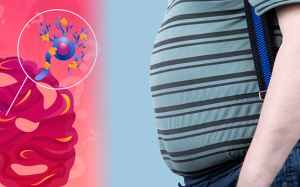 Bụng tích nhiều mỡ nội tạng, coi chừng nguy cơ mắc Alzheimer