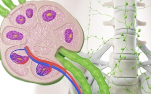 Điều trị biến chứng rò bạch huyết với kỹ thuật bơm thuốc cản quang 