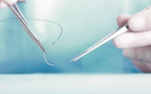 Cấy chỉ: Bước tiến mới trong điều trị bằng Y học cổ truyền