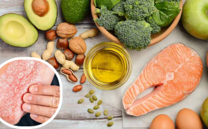 Chế độ ăn cho người bệnh vẩy nến