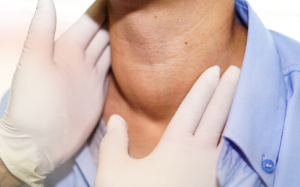 Bướu giáp nhân không độc là gì, làm sao để cải thiện?