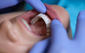 Bệnh nướu răng và não bộ: Mối liên hệ là gì?