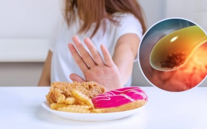 Sỏi túi mật 7mm nên ăn gì để không phải cắt túi mật?