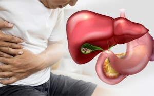 Sỏi mật kèm đái tháo đường có dùng được TPBVSK Kim Đởm Khang không?