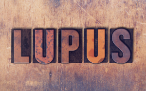 Lupus biến chứng suy thận và những điều bạn cần biết