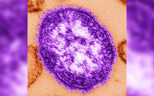 Mỹ: Bùng phát dịch sởi, CDC ban bố cảnh báo đi lại