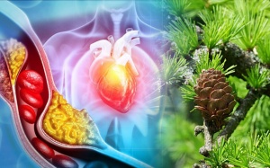 Hẹp mạch vành kèm mỡ máu cao, tăng huyết áp dùng được thảo dược nào?