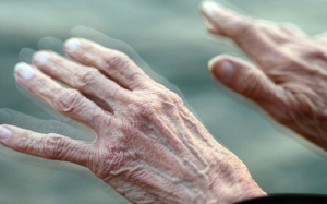 8 dấu hiệu nhận biết sớm bệnh Parkinson 
