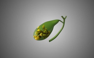 Sỏi bùn mật có thể chuyển thành dạng viên không?