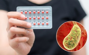 Thường xuyên dùng thuốc tránh thai có làm tăng nguy cơ sỏi mật?