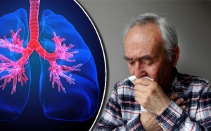 4 giai đoạn phát triển của bệnh phổi tắc nghẽn mạn tính 