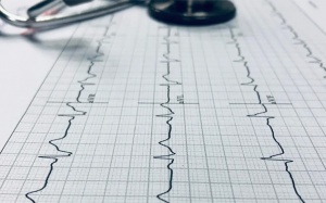 Tầm quan trọng của việc chẩn đoán sớm bệnh rung nhĩ