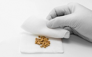 Sỏi mật 7mm có nguy hiểm không và cần xử trí thế nào?