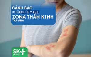 Podcast: Cảnh báo không tự ý trị zona thần kinh tại nhà