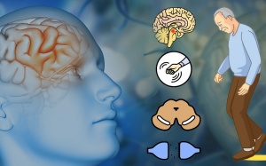 7 tác nhân làm tăng nguy cơ mắc bệnh Parkinson