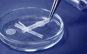 Người bệnh tim có thể đặt tối đa bao nhiêu stent?