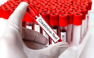 Cách kiểm soát creatinin ở người bệnh suy thận