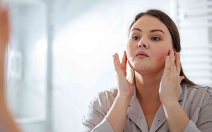 Suy thận bị phù mặt phải làm sao?