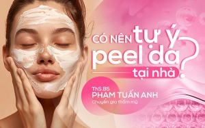 Có nên tự ý peel da tại nhà?