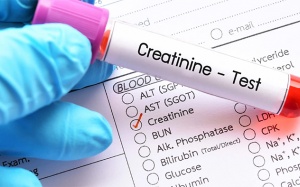 Chỉ số creatinin tăng có phải bị biến chứng thận do đái tháo đường?