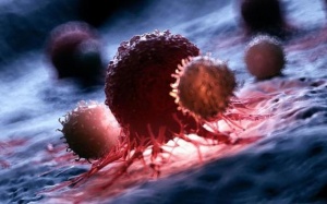 Nghiên cứu: Liệu pháp mới điều trị ung thư vú ác tính đạt tỷ lệ sống sót 100%