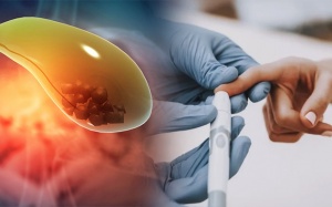 Sỏi bùn túi mật kèm đái tháo đường dùng TPBVSK Kim Đởm Khang được không?