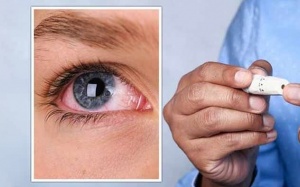 Đái tháo đường: Các thảo dược giúp cải thiện biến chứng mắt