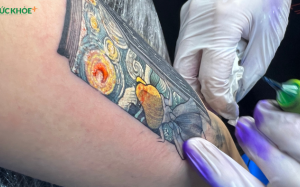 Xăm hình làm tăng nguy cơ mắc ung thư máu?