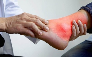 Chế độ ăn cho người bị đau gout cấp: Nên ăn và kiêng gì?