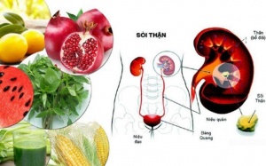 Chuyên gia chỉ cách ăn uống cực kỳ đơn giản 'đánh tan' sỏi thận